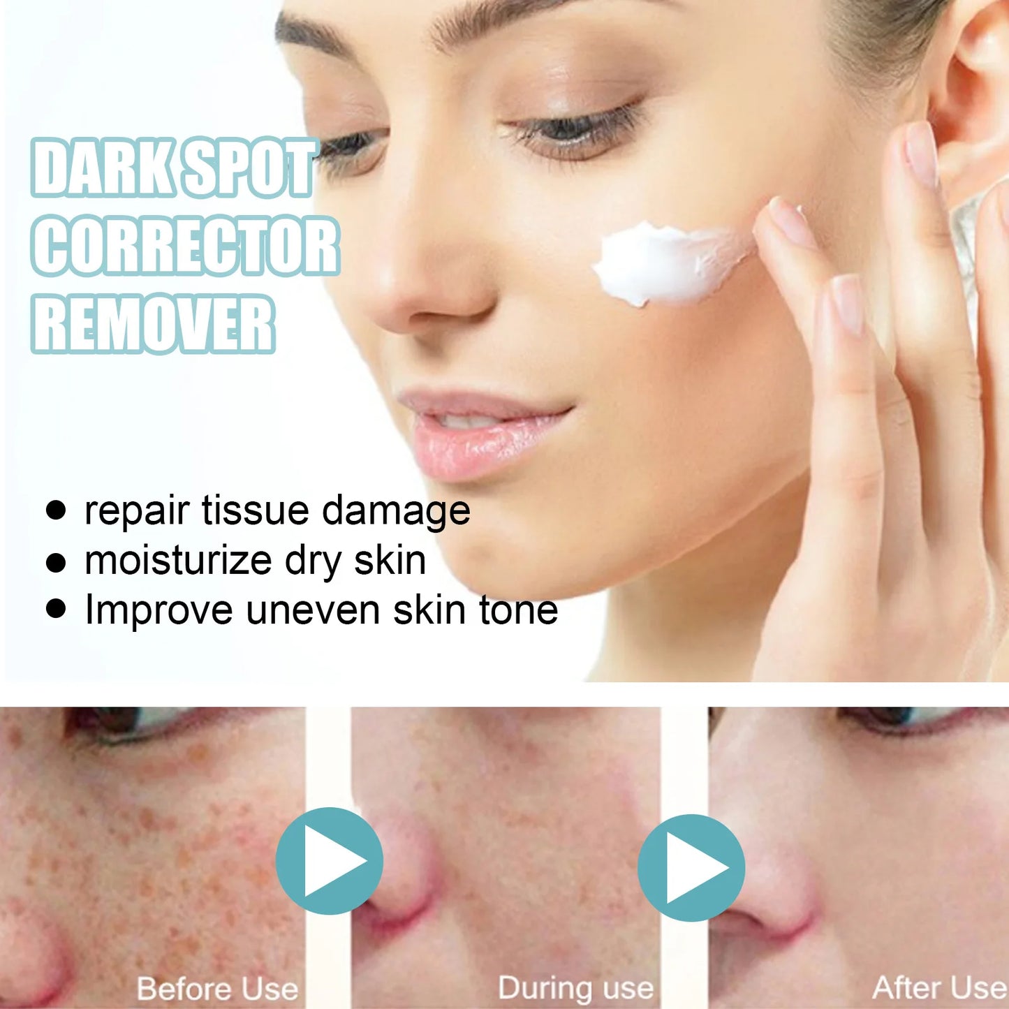 Eelhoe Dark Spot Corrector Remover